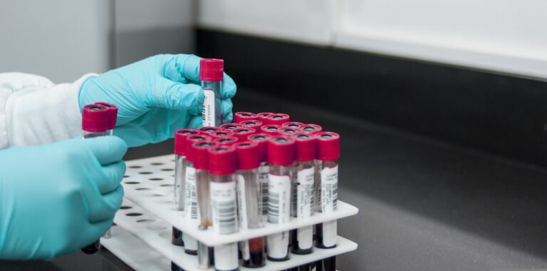 veriputkia laboratoriossa